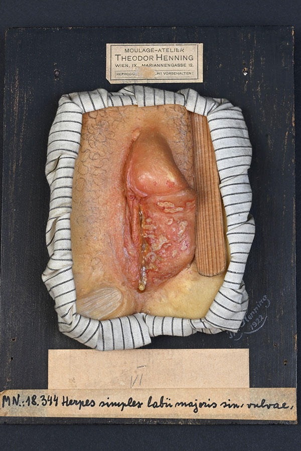  Herpes, Moulage © NHM Wien, C. Potter