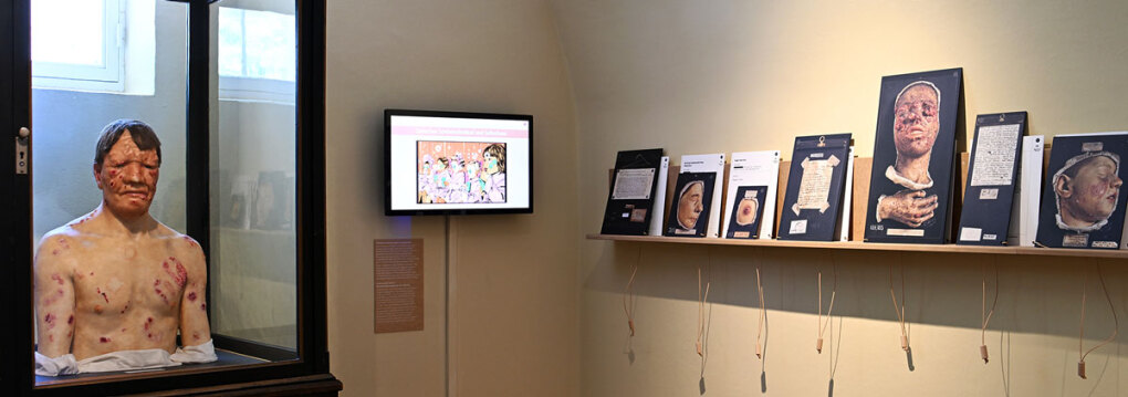  Die Kunst der Moulage. Ausstellungsansicht © NHM Wien, Chloe Potter