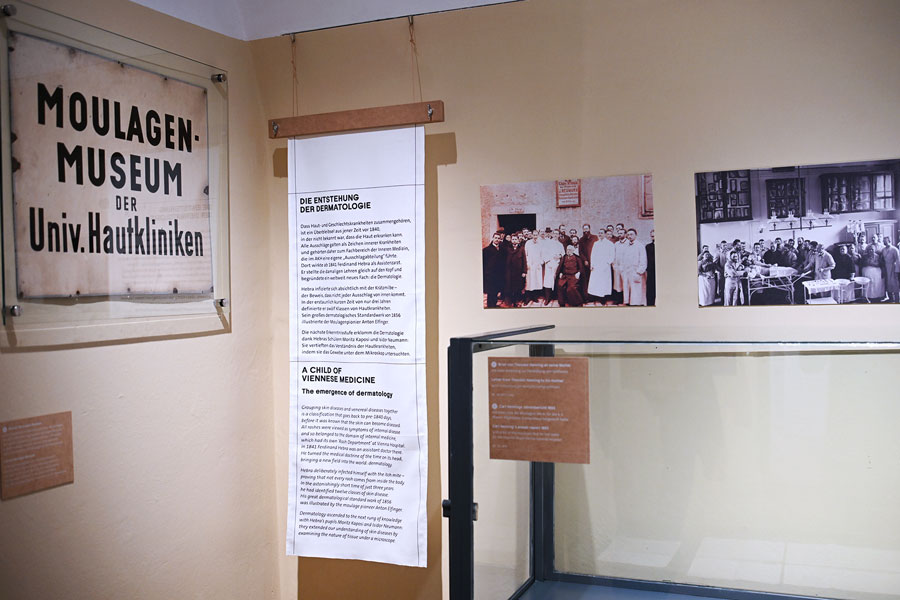 Die Kunst der Moulage. Ausstellungsansicht © NHM Wien, Chloe Potter
