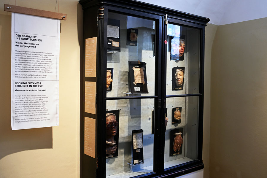 Die Kunst der Moulage. Ausstellungsansicht © NHM Wien, Chloe Potter